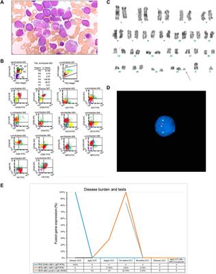 BCR-ABL1-positive acute lymphoblastic leukemia following successful treatment of acute promyelocytic leukemia: case report